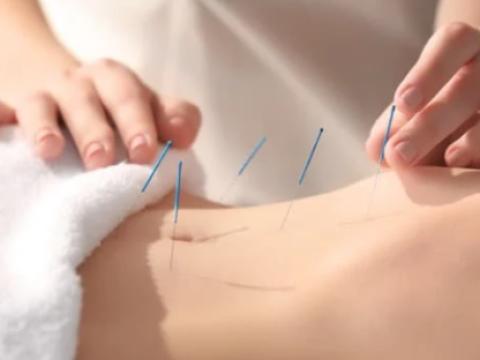 Lara Tisseur Acupuncture
